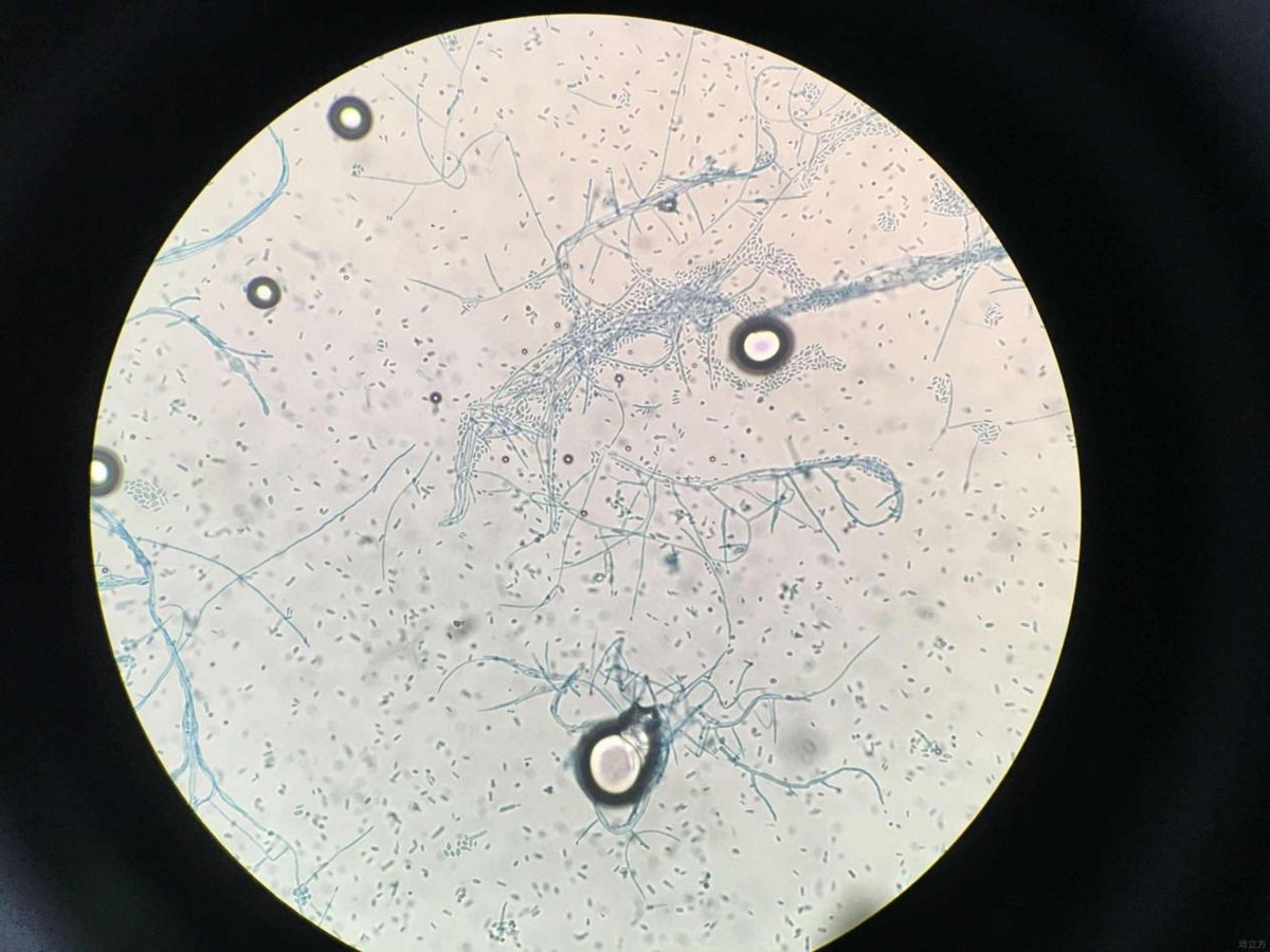 粮食中真菌的检测,粮食中真菌毒素检测的优缺点