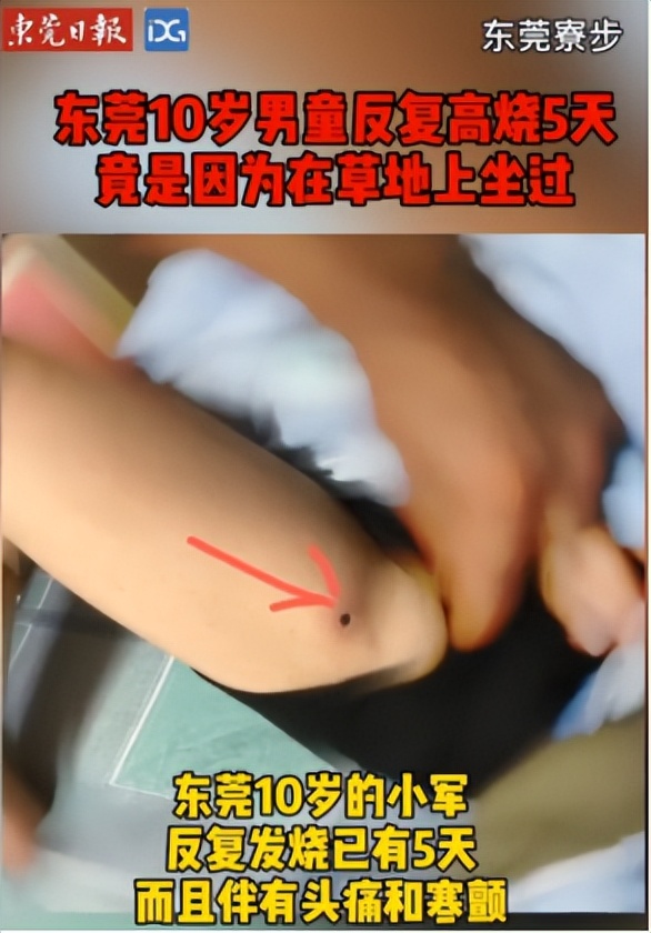 恙虫到底有多可怕？致死率极高