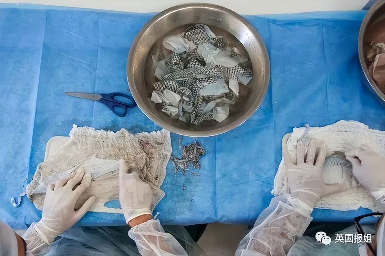 一男子为了变性为女生,竟然用鱼皮造了*体下**