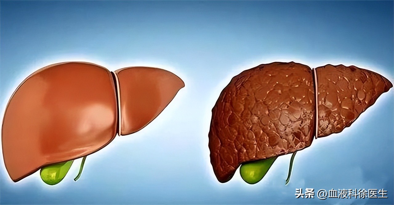 养肝护肝的早餐食谱,养肝护肝的早餐