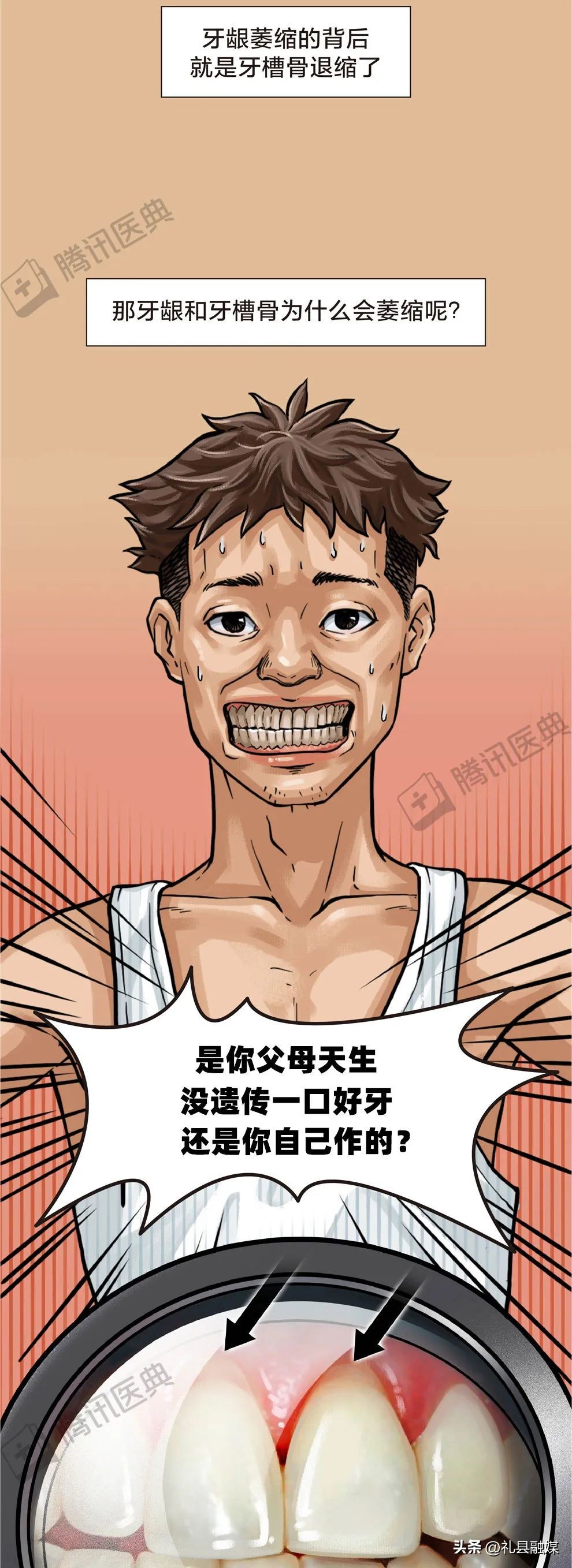 牙缝隙大吃菜就塞牙怎么修复,牙齿吃菜老塞牙怎么办