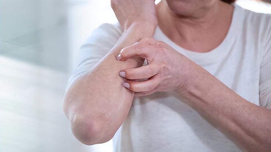 皮肤病止痒最有效的方法,皮肤痒快速止痒的哪三个方法