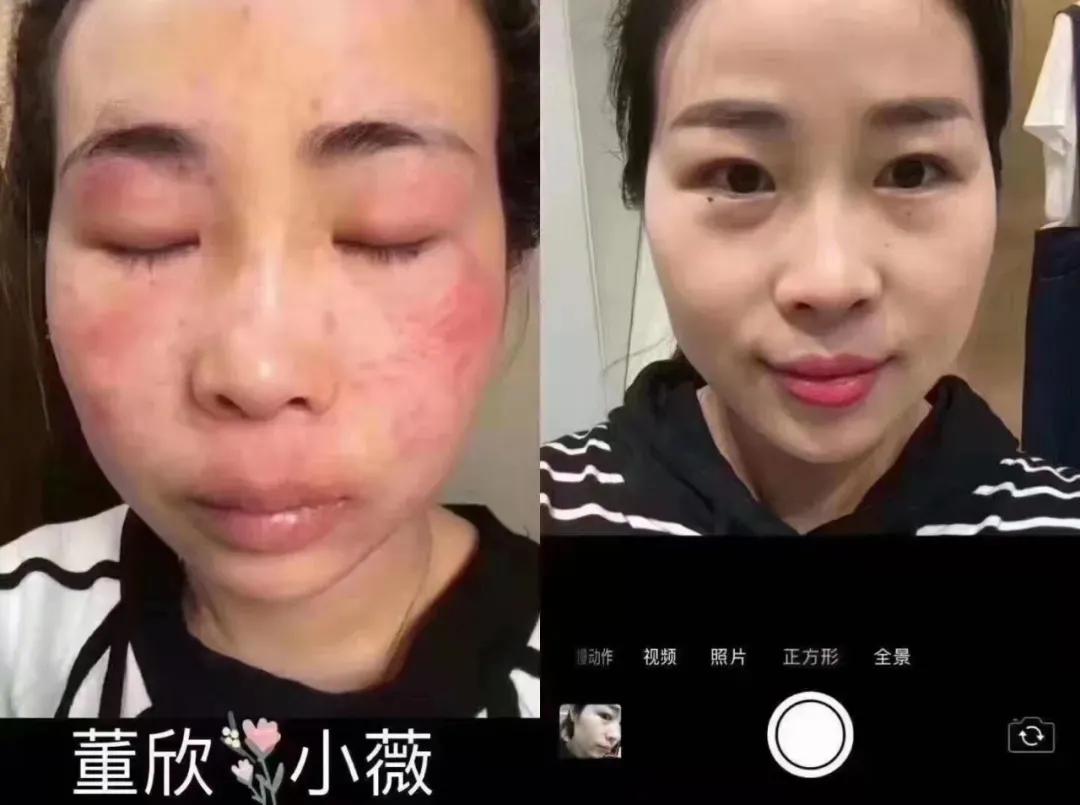 董欣护肤品哪个好用,董欣护肤品推荐