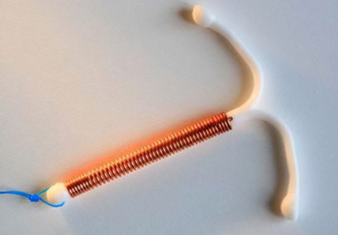 为什么月经过后会出现褐色血,51岁月经结束后有少量褐色分泌物