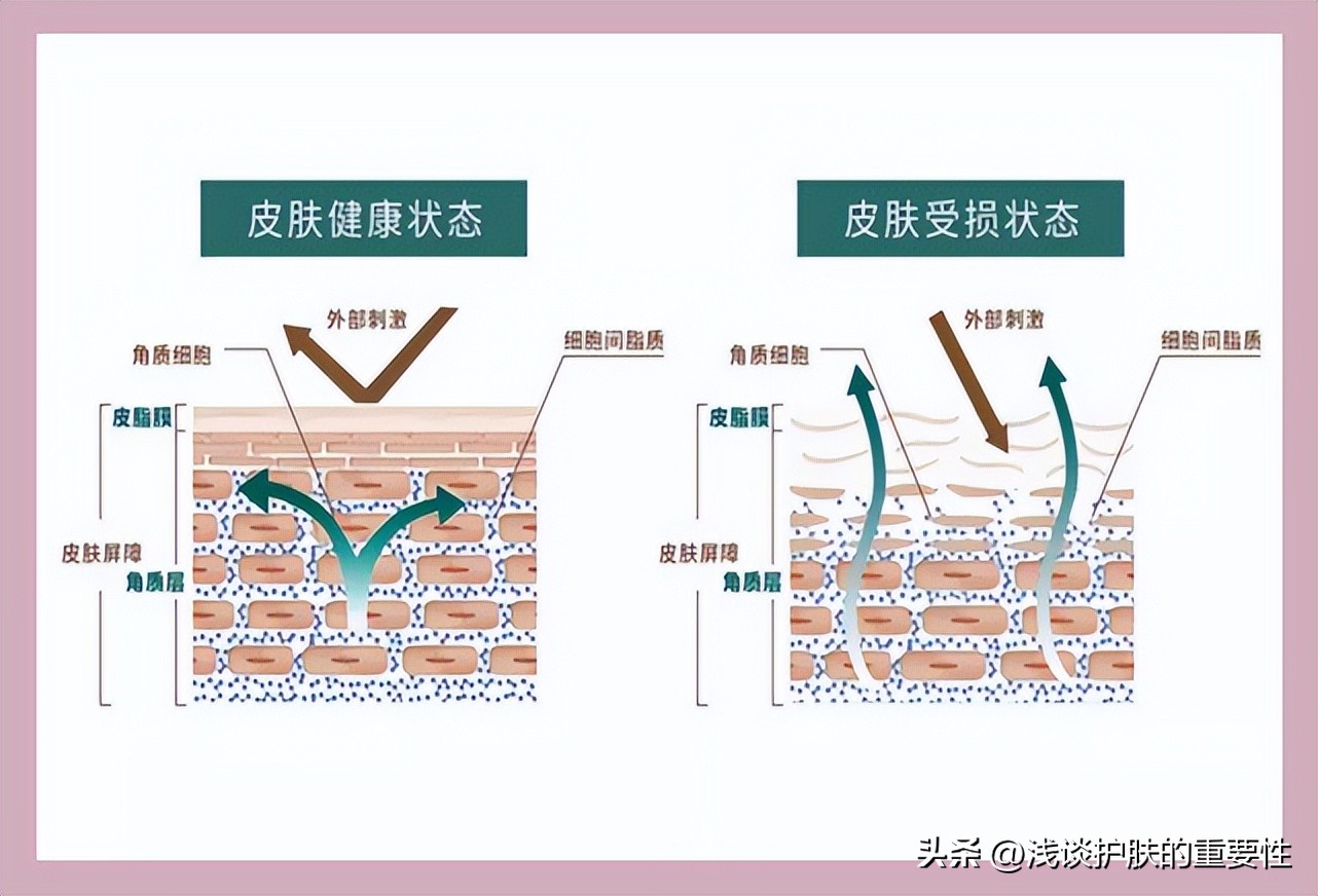 敏敏肌护肤秘籍你get到了吗,敏敏肌可以护肤吗
