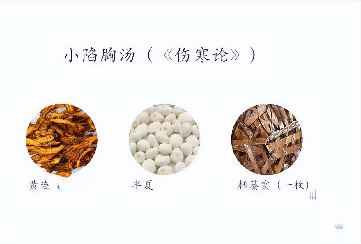 治咳嗽化痰的最好土方法,成人咳嗽止咳化痰最快的一招秘方