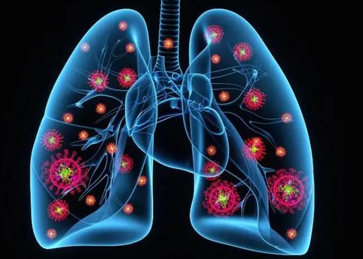 医学科普过敏性鼻炎,中国变应性鼻炎诊断和治疗指南