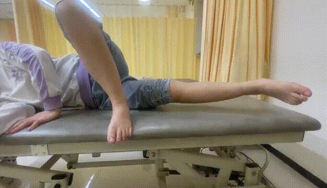 怎么走路改善xo型腿,什么走路姿势可以纠正o型腿