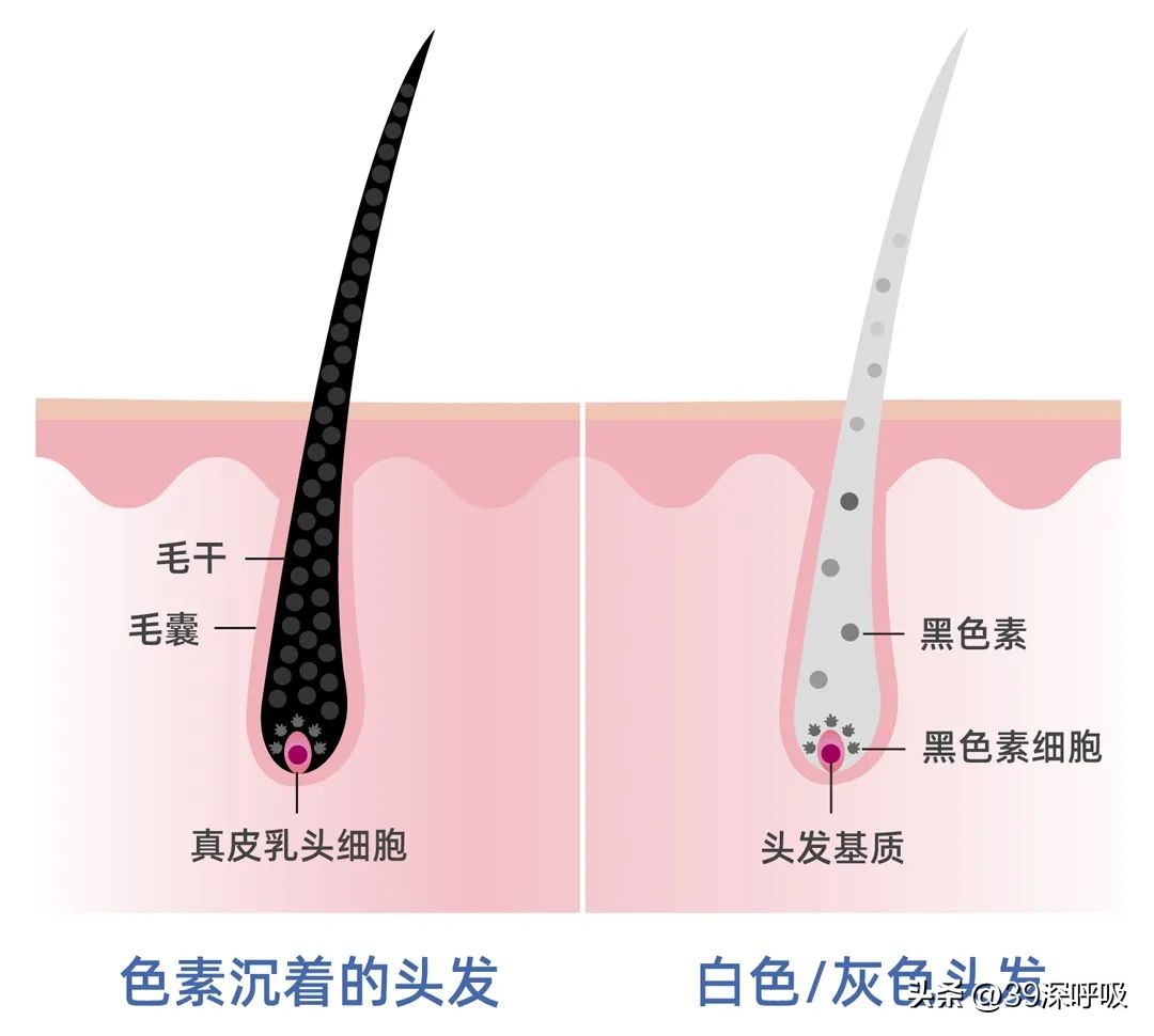 治疗白发转黑发的骗局,白发15天转黑发靠谱吗