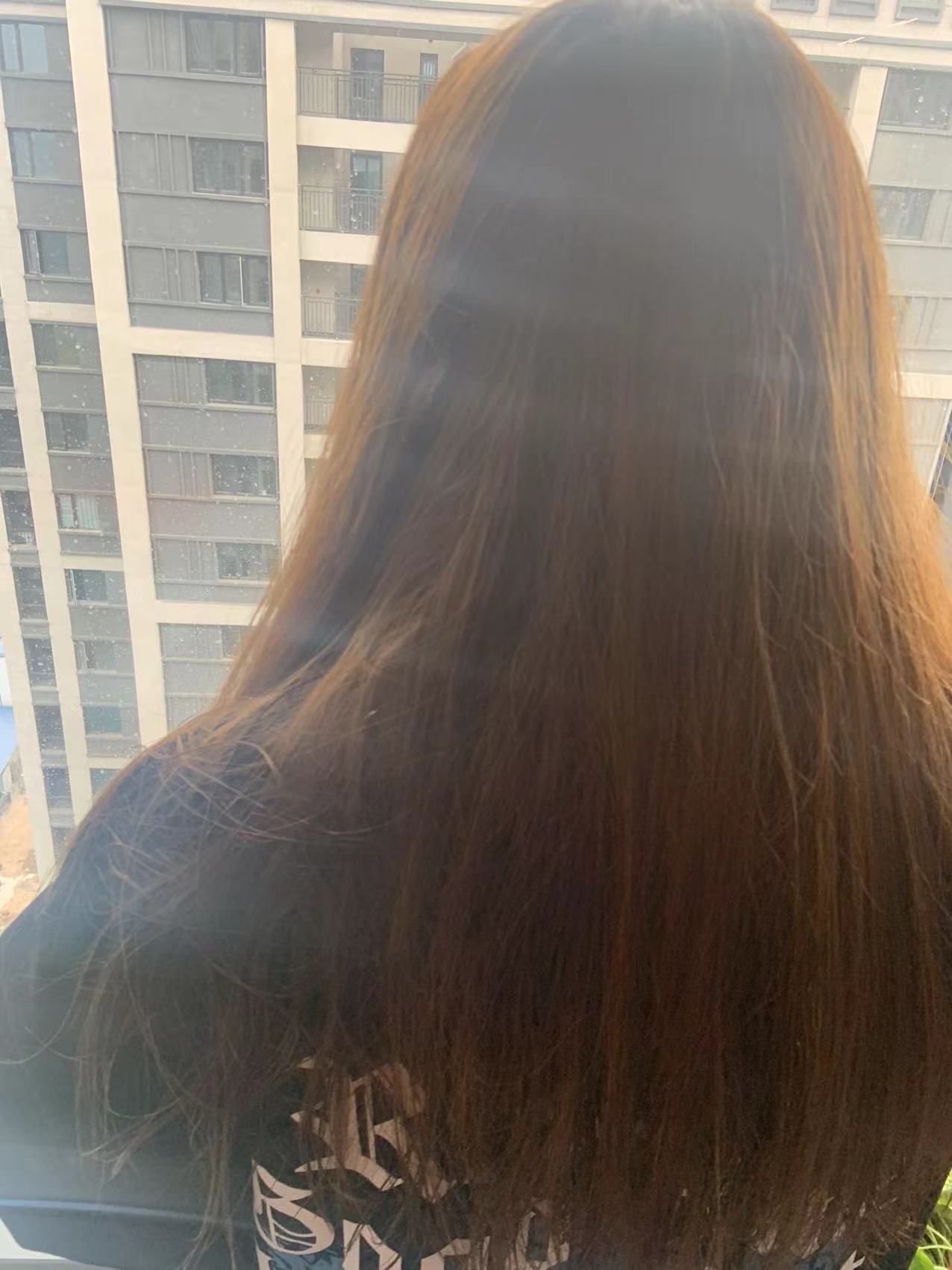 去除顽固头屑的洗发水推荐,治疗头屑用洗发水推荐哪款