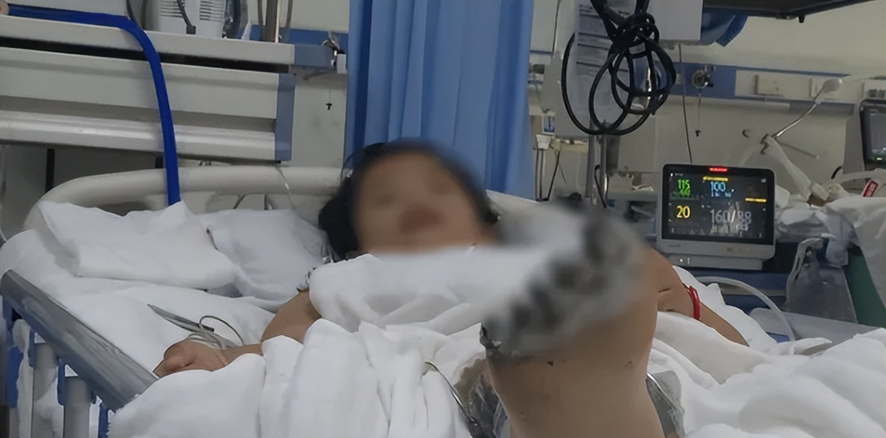 苹果充电被电截肢,苹果手机充电被电击事件