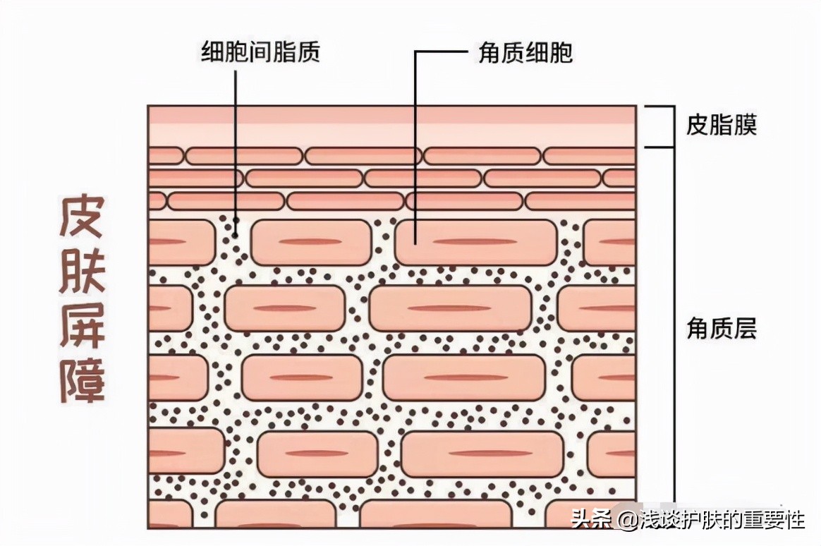 冬天皮肤干燥夏天出油用什么保湿,冬季油性皮肤干燥怎样补水更有效