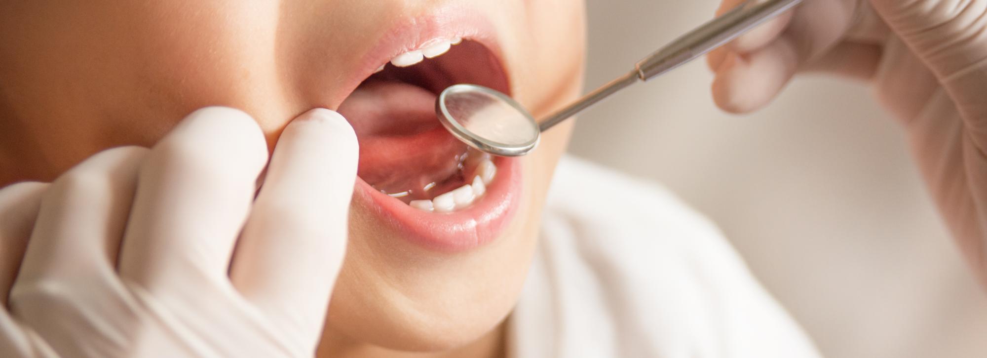 成都海关唾液样本是否有病毒,物品携带细菌病毒