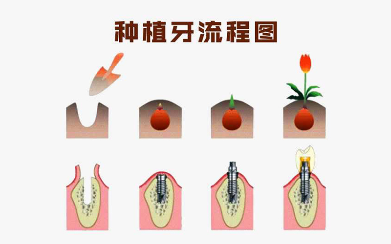 缺牙时间久镶牙位置不够怎么办,缺牙太久局部矫正