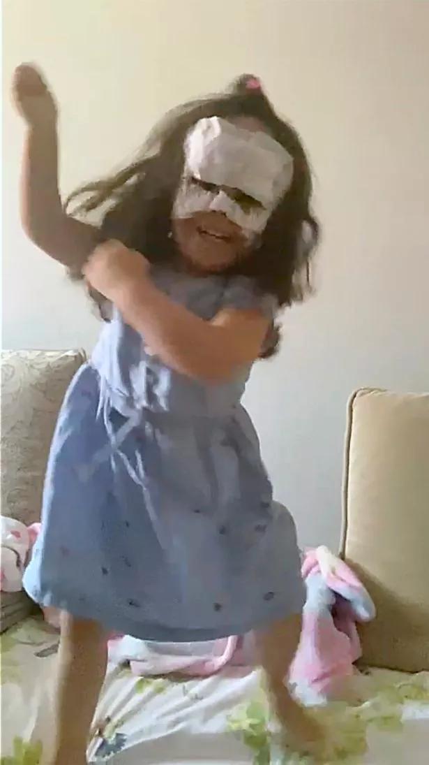 美国小女孩脸带“蝙蝠侠”黑印,治疗两年经过终于恢复肉色!