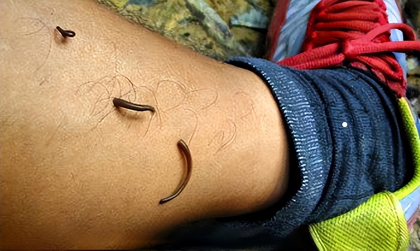 原始森林里面的蚂蟥有天敌吗,蚂蟥有什么天敌