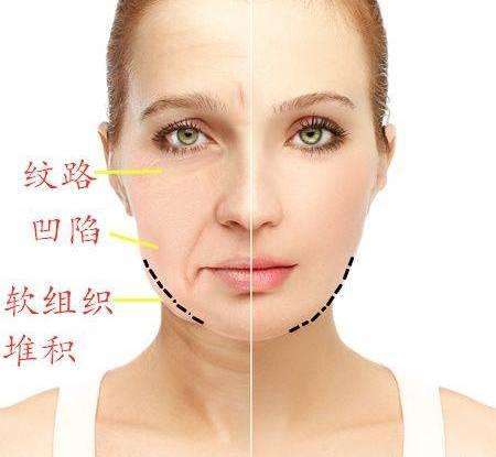 为什么随着年龄脸越来越大,为什么随着年龄的增长脸越来越宽