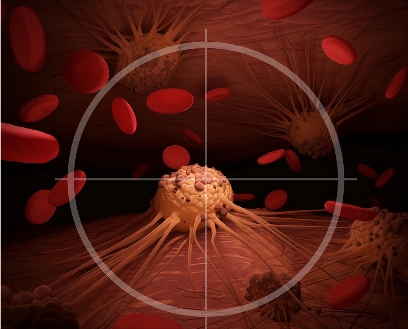 70岁癌晚期扩散了还能活多久,70多岁癌症晚期扩散还适合化疗吗