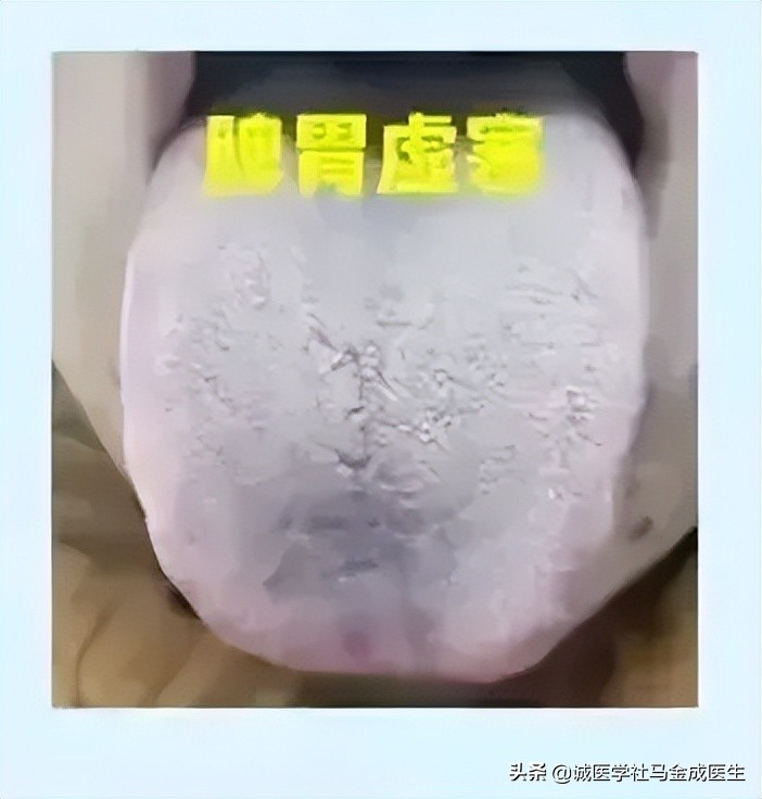 5岁小孩脾胃差吃什么中成药调理,脾胃肝肾肺亏损全部调理的中成药