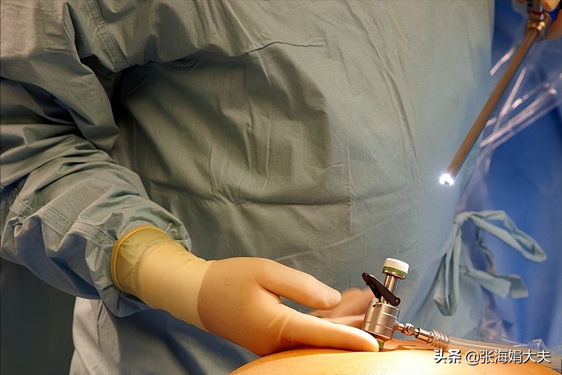 男人备孕需要检查哪几项,备孕4个月未怀上需要做哪些检查