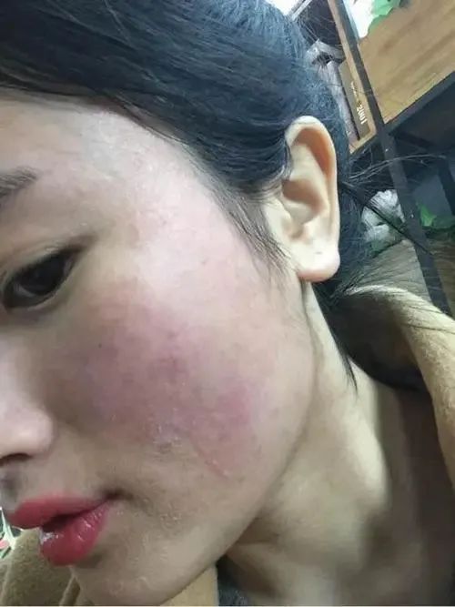 皮肤过敏科普医生,杏林微科普全集