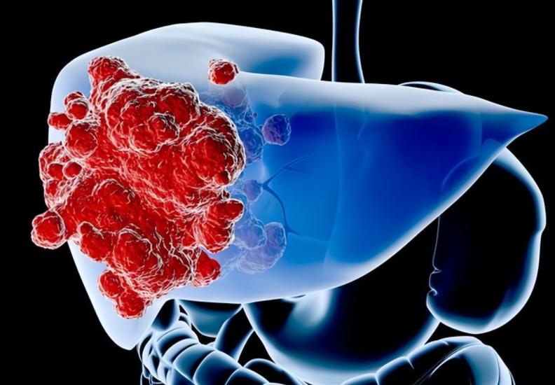 医生说是囊肿是什么意思,医生说有个囊肿是怎么回事