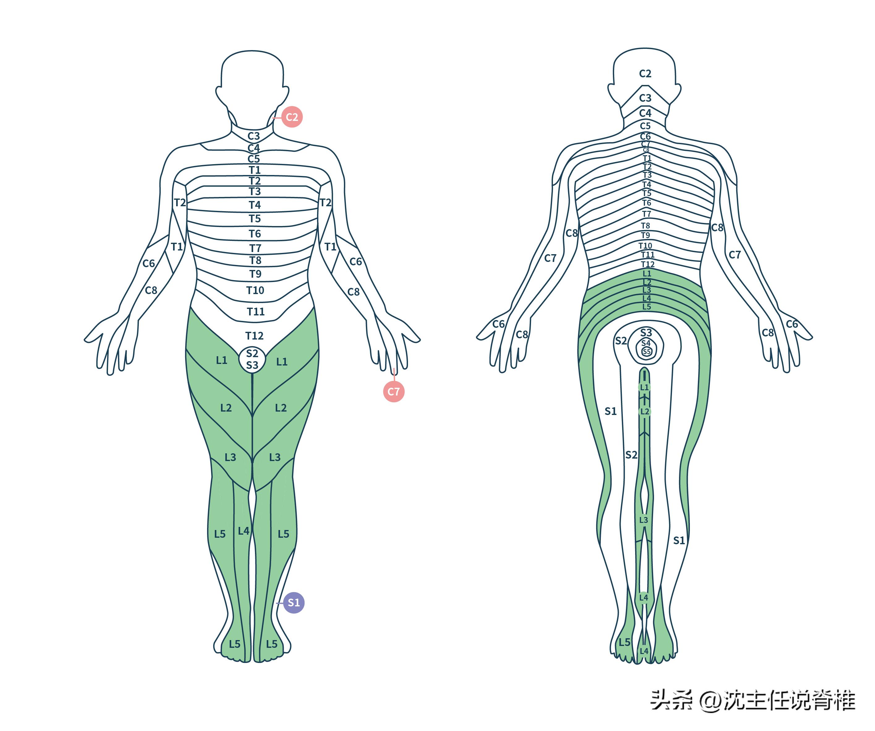 腰椎间盘突出臀部肌肉减少怎么办,腰椎间盘突出引起臀部痛如何治疗