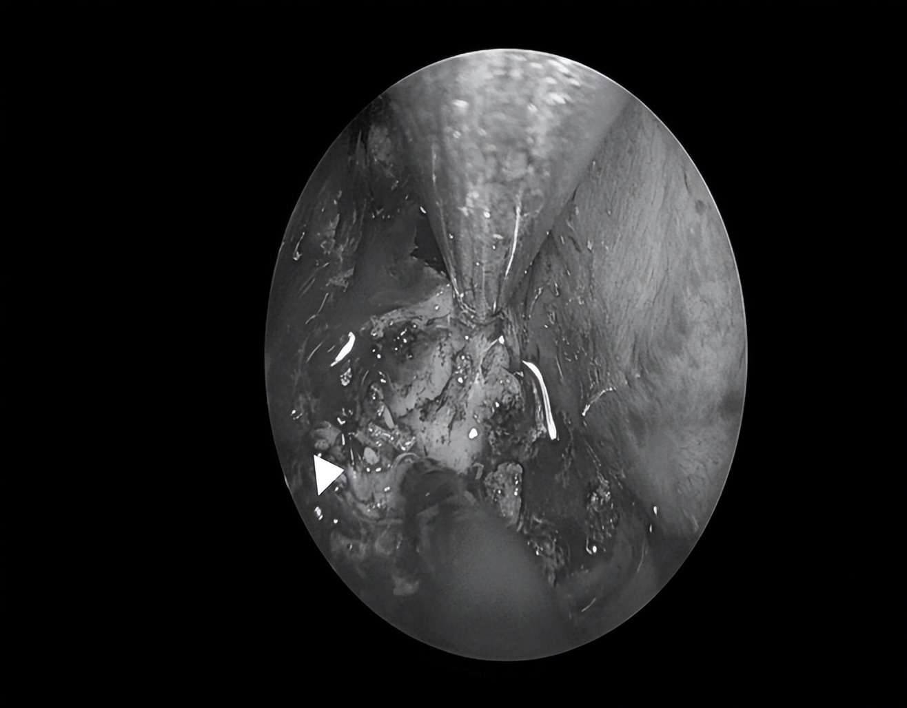 南昌二附院耳鼻喉科手术,南昌大学第二附属医院耳鼻咽喉科