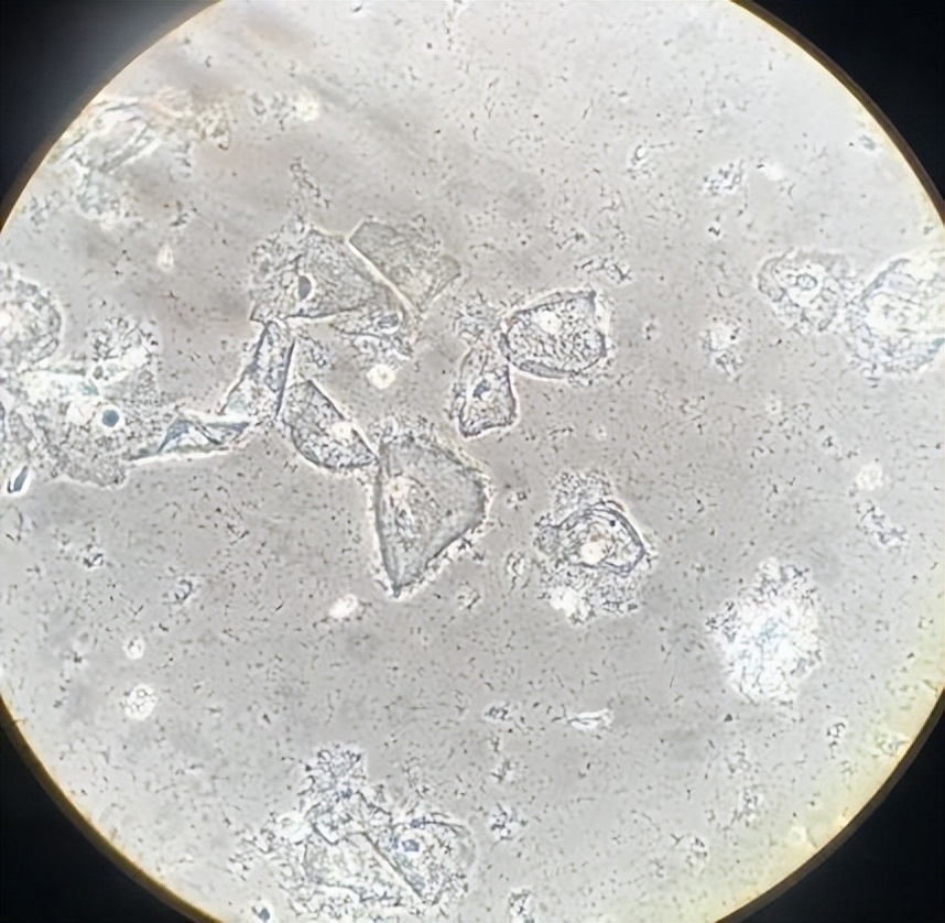 阴道菌群为什么会混乱,阴道菌群怎么分类