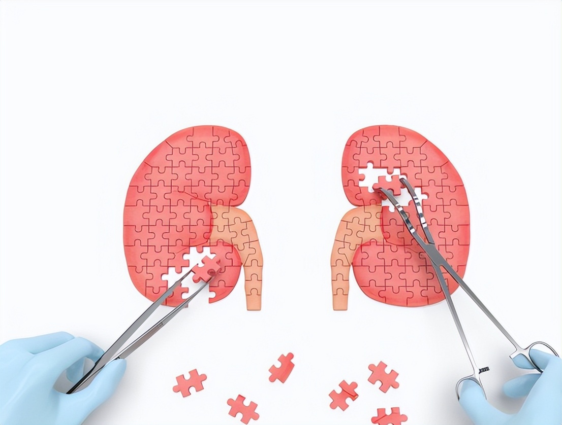 肌酐高就是代谢功能差吗,肾功能肌酐正常尿常规肌酐高