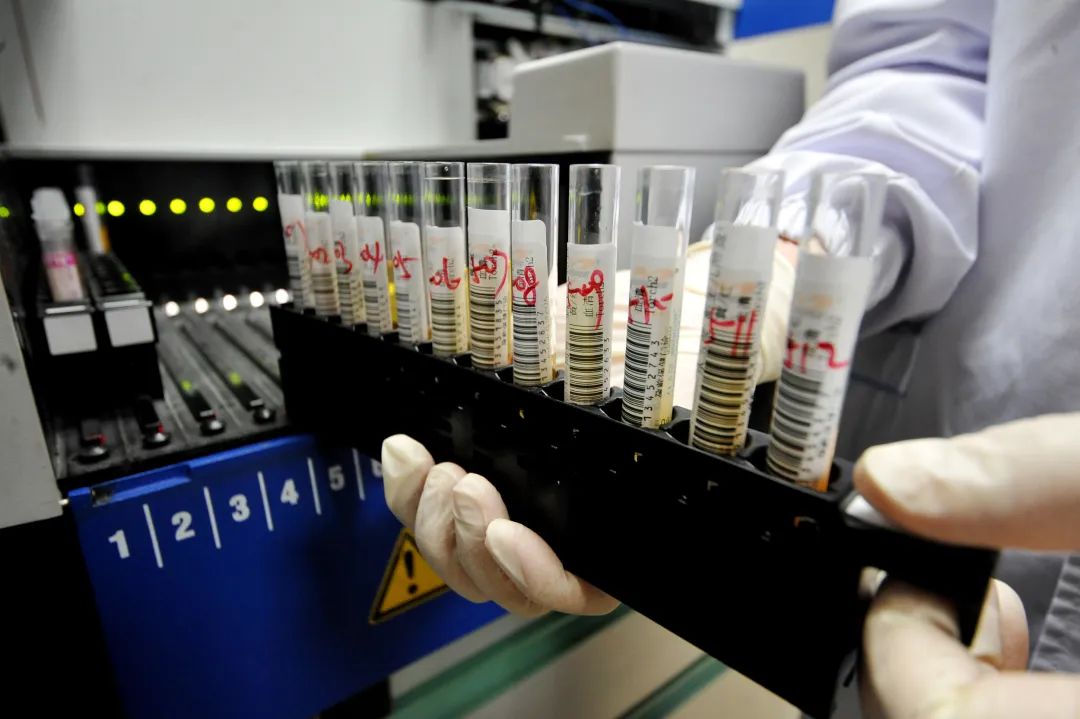 刚出生的婴儿会有遗传病吗,刚出生不久的小孩血液有致聋基因