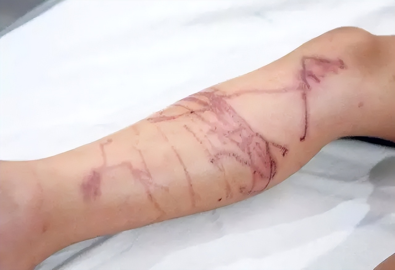 世界上最具致命毒性的动物,世界上最恐怖的10种有毒动物