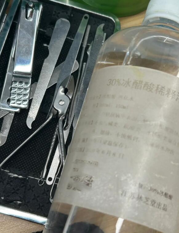 如果染上灰指甲该怎么解决,和有灰指甲的人在一起怎么避免