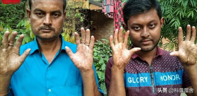 人类指纹的斗和簸箕有什么秘密,人类指纹有哪些类型特征是什么