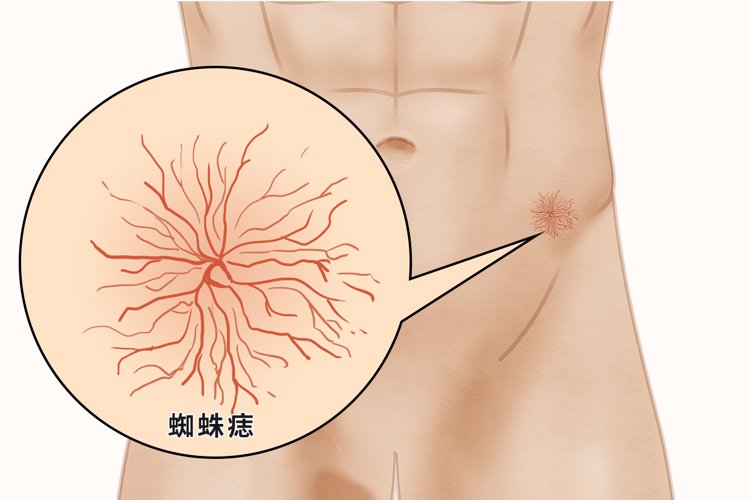 经常放屁肚子胀气是肝的惨叫信号,经常放屁就是肝不好吗