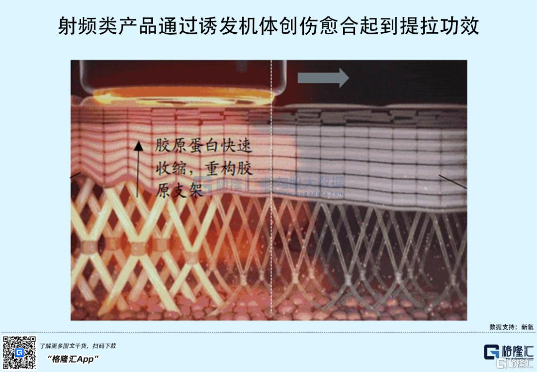 医美玻尿酸发展趋势,医美玻尿酸前景如何