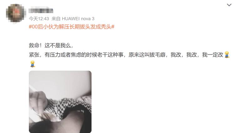 青少年拔白头发解压,小伙为解压拔发成秃头