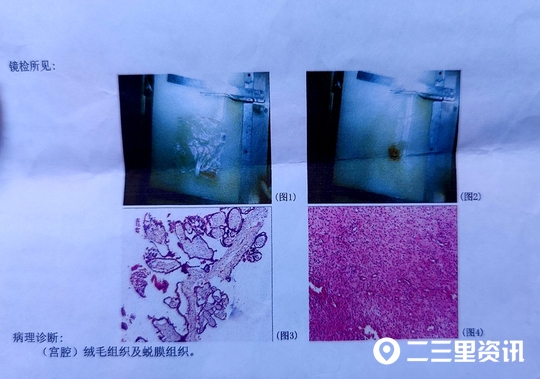 人流手术半个月后依然孕吐，咸阳风轮医院：手术有残留
