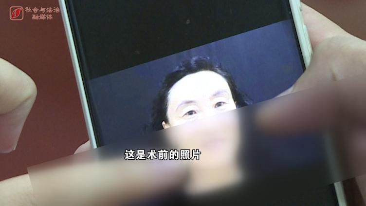 太原华美医疗美容医院双眼皮,太原华美医疗美容医院割双眼皮