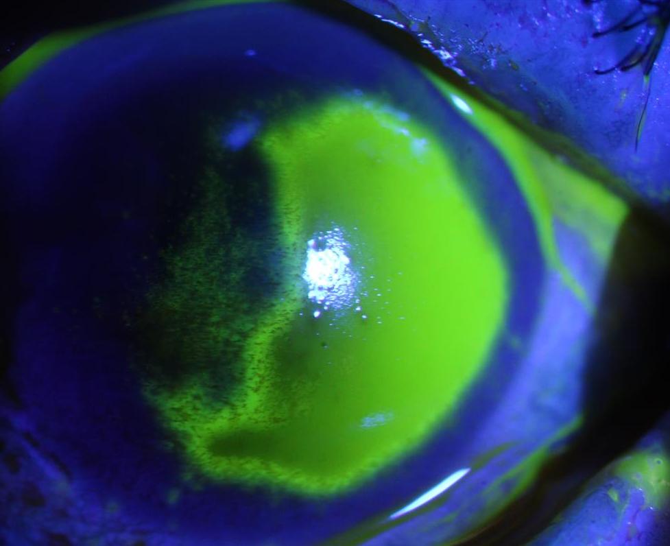 自己在家染发如何保护眼睛,染发真的会伤害眼睛吗