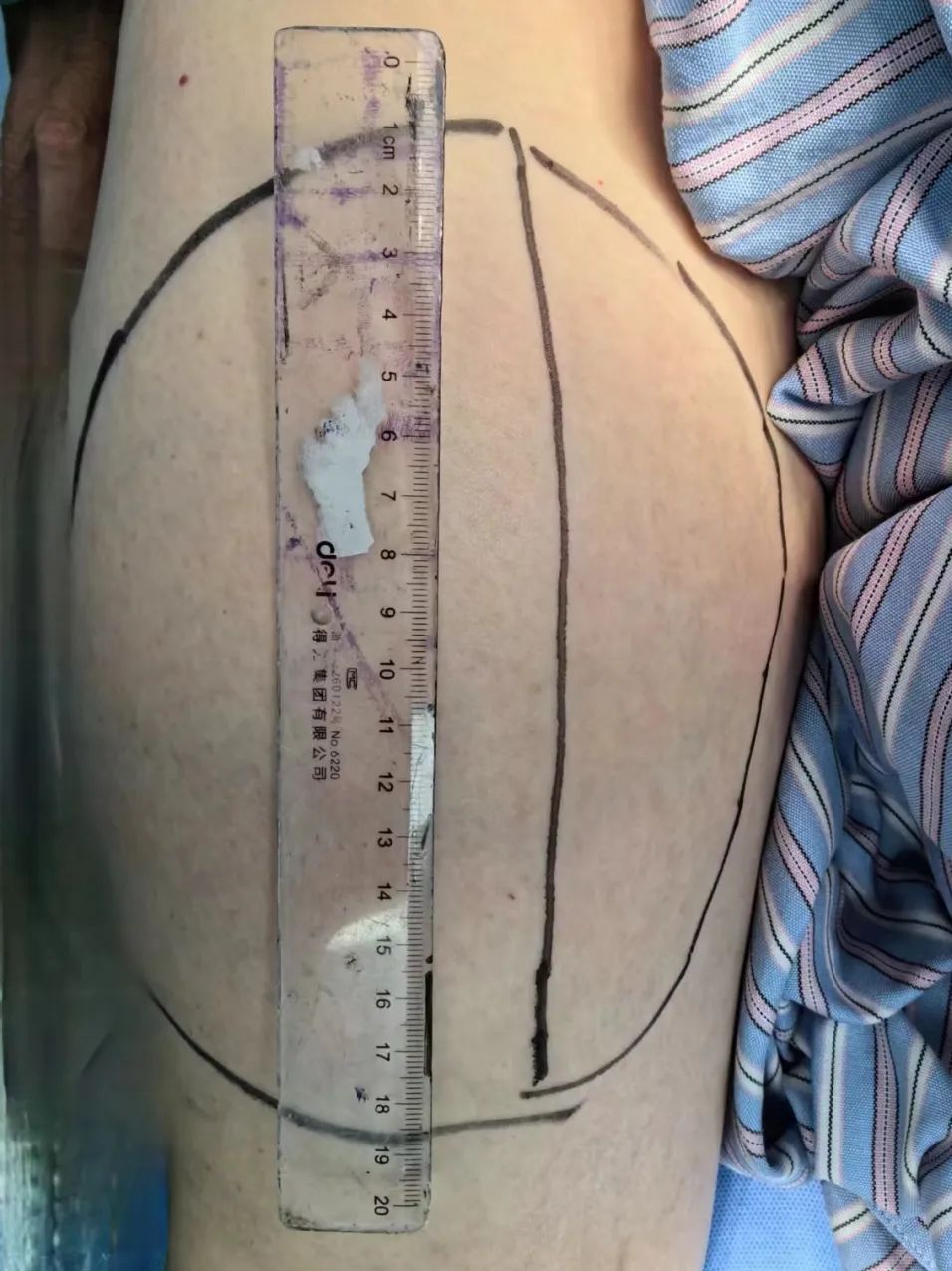 多学科协作治疗肿瘤,多学科联合救治打通生命通道