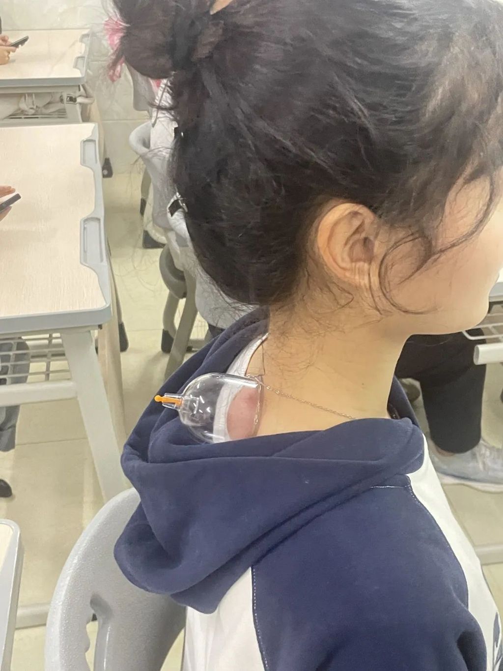 帅气老师扎头发,头发上拔罐的技巧